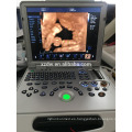 DW-C60plus portátil 3D 4D color doppler máquina de ultrasonido con aprobación CE